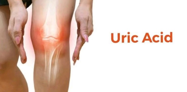 High Uric Acid: Causes, Symptoms and How to Reduce It