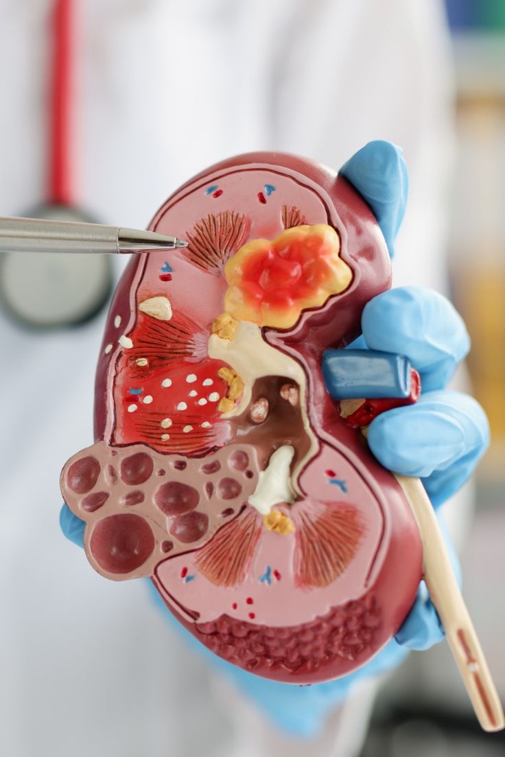 What are some signs of kidney problems? How do I know if my kidneys are working well?